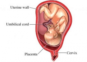 Placenta als tweelingdeel